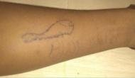Blue Whale challenge: 19-year-old boy commits suicide