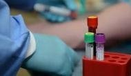 Study: Immune system treatment to reduce stress can prevent cancer metastases
